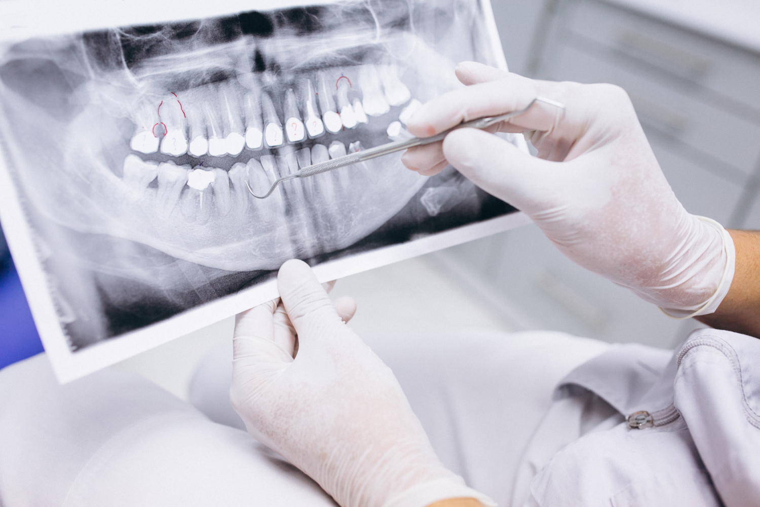 cirugía oral y maxilofacial